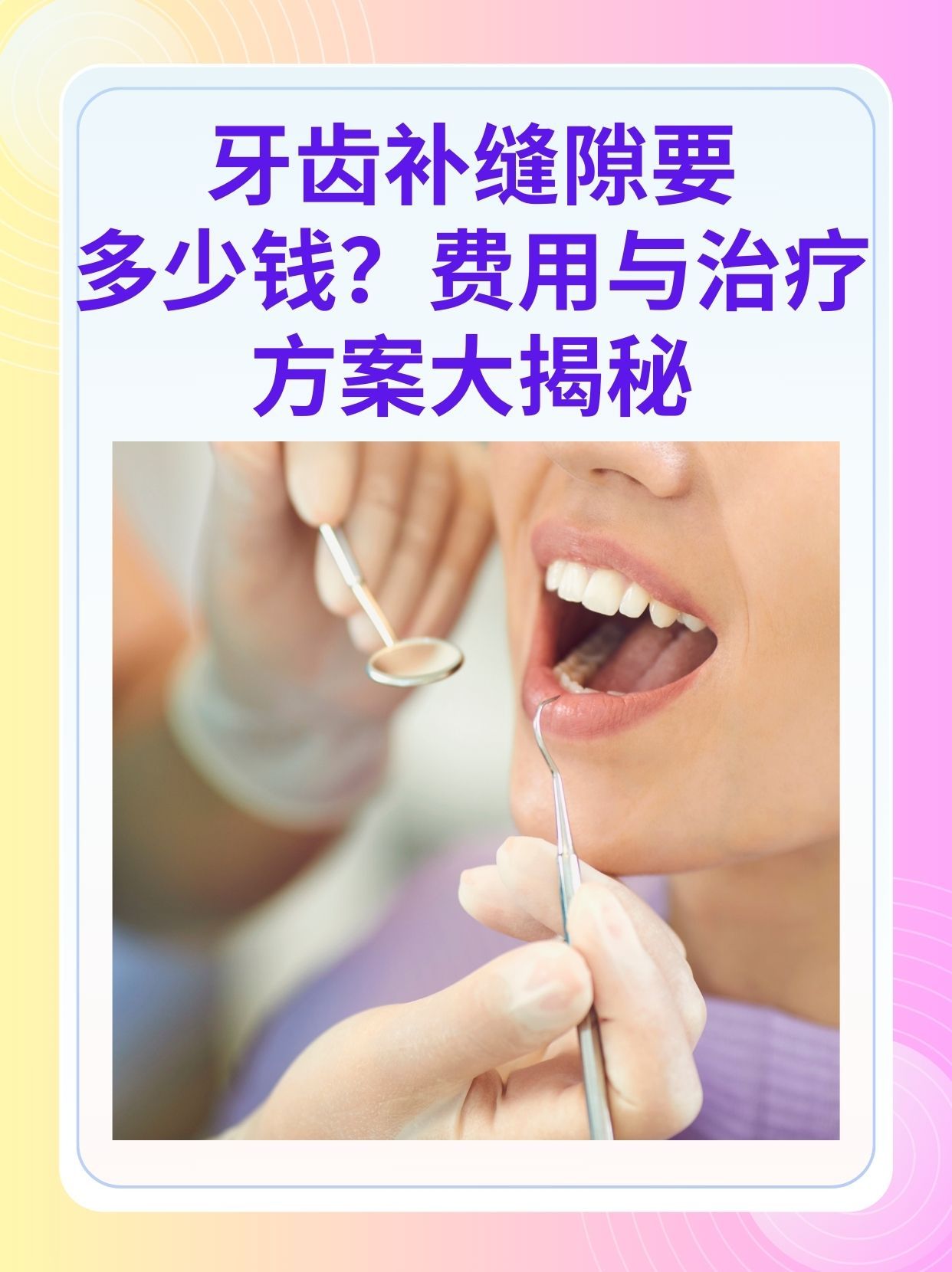 佛山补牙医保可以报销吗(补牙医保可以报销吗 哪些可以报销呢)